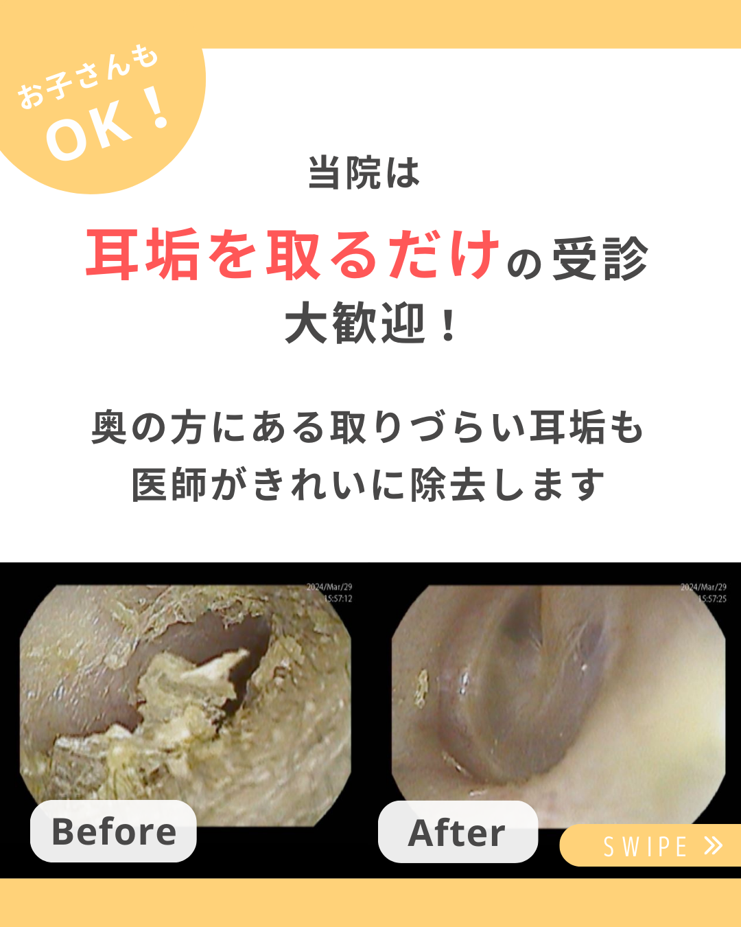 医療の豆知識